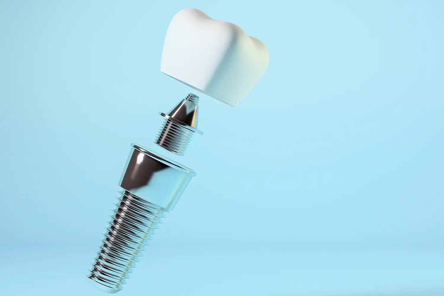 Dentist-In-Portland-OR-Can-I-Get-Dental-Implants-if-I-Have-Gum-Disease