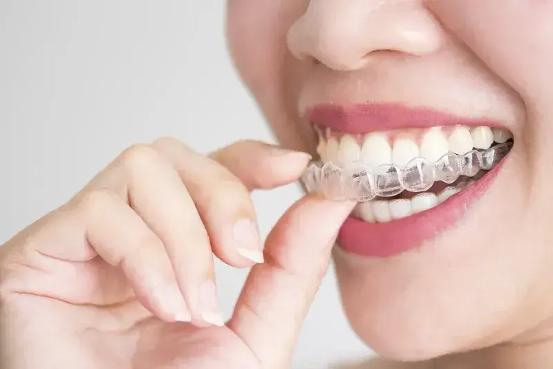 Dentist-In-Portland-OR-Can-You-Wear-a-Mouthguard-With-Invisalign