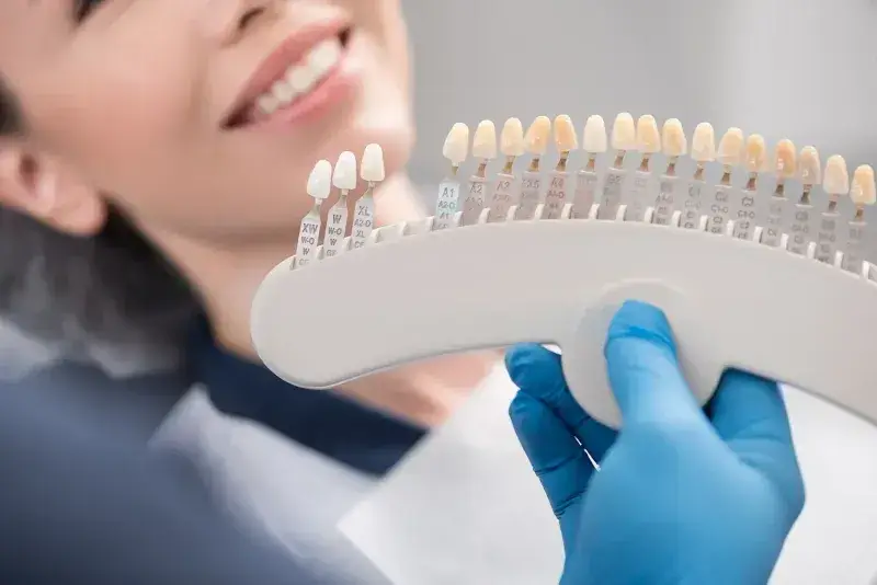 Dentist-In-Portland-OR-The-Difference-Between-Bonding-and-Veneers