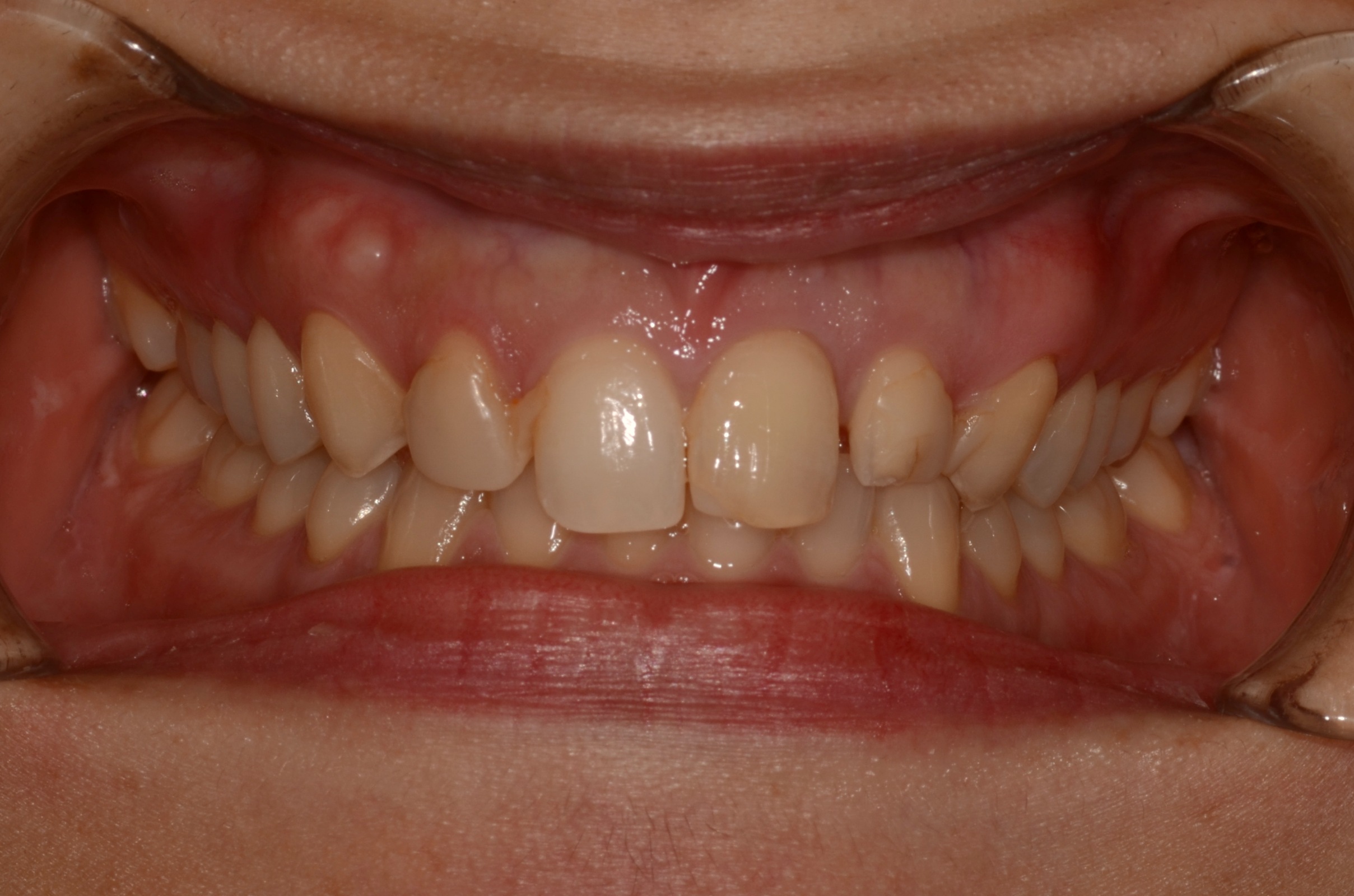 Five Pines Dental Five Pines Dental