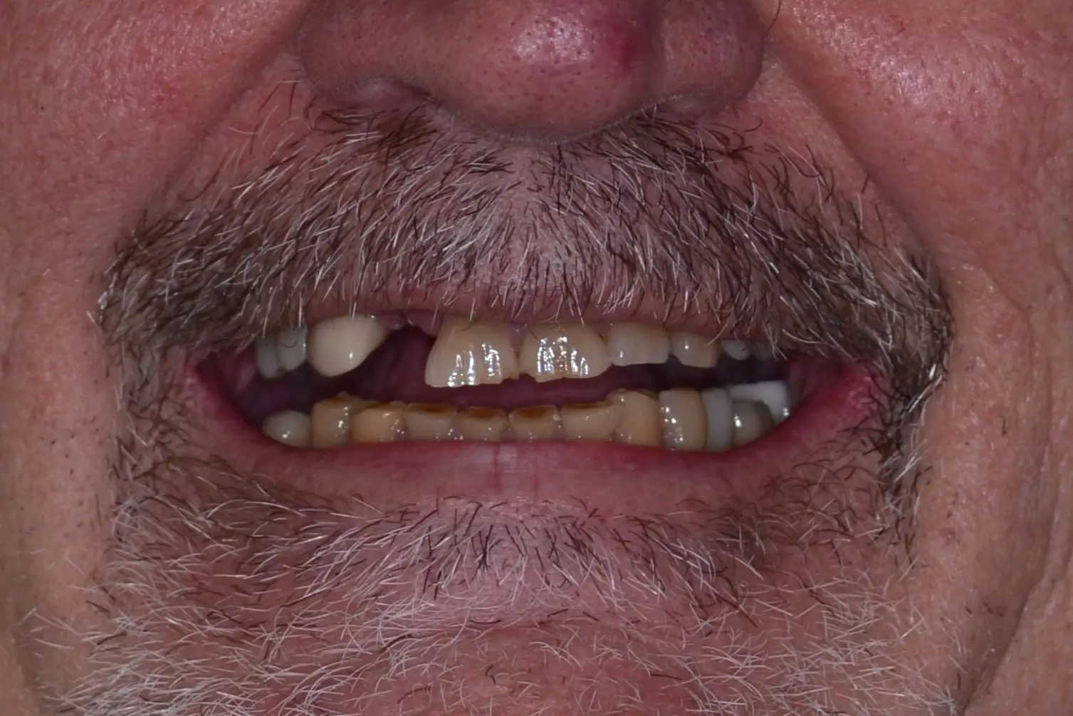 Pt8 Before Pt8 Before